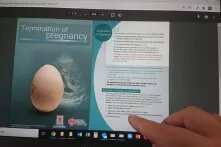 For women eligible for legal abortion in Hong Kong, access to medical services may be hindered by gestational duration, waiting time in public sector, costs in private sector, and judgemental attitudes from conservative healthcare workers.